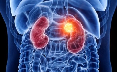 Como aquecimento global pode estar por trás de 200 mil casos de doença renal no Brasil