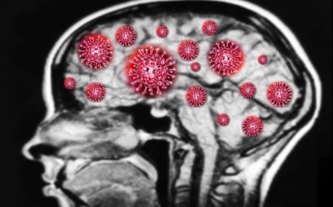 Covid-19 pode aumentar riscos de doenças como Alzheimer e Parkinson