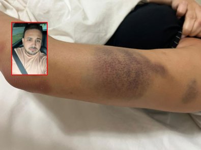 Após 16 dias, empresário acusado de espancar namorada se entrega em Cuiabá