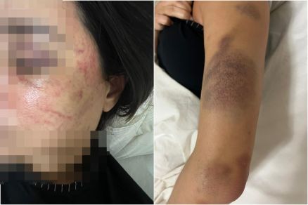 Acusado de agredir namorada em Cuiabá está foragido há 9 dias