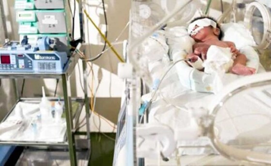 MT:  CAUSAS EVITÁVEIS:  Cuiabá tem um dos maiores índices de morte de bebês por diarreia