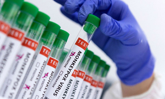 MT:  MONKEYPOX VÍRUS:   Mato Grosso registra 2 casos positivos para a varíola dos macacos