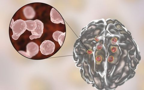Fungo pode mudar de forma para entrar no cérebro humano