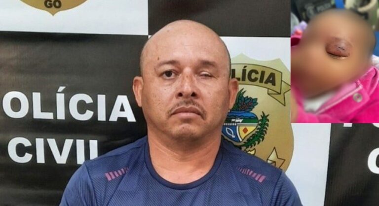 1 MÊS DE IDADE: Homem é preso por agredir filha recém-nascida com soco