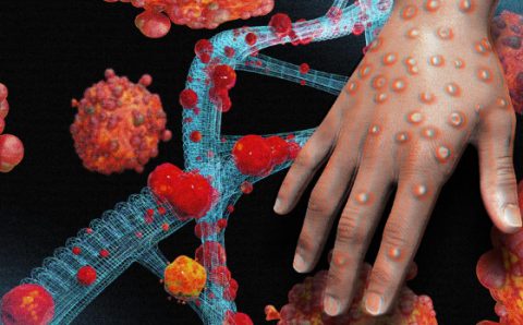 MT:  SAÚDE EM ALERTA:    MT é o 15º estado com mais casos de varíola dos macacos