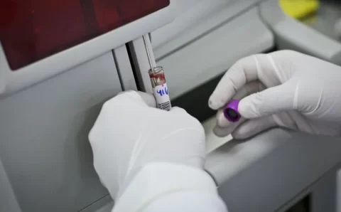 Laboratório Central de Mato Grosso realizou cerca de 700 mil exames