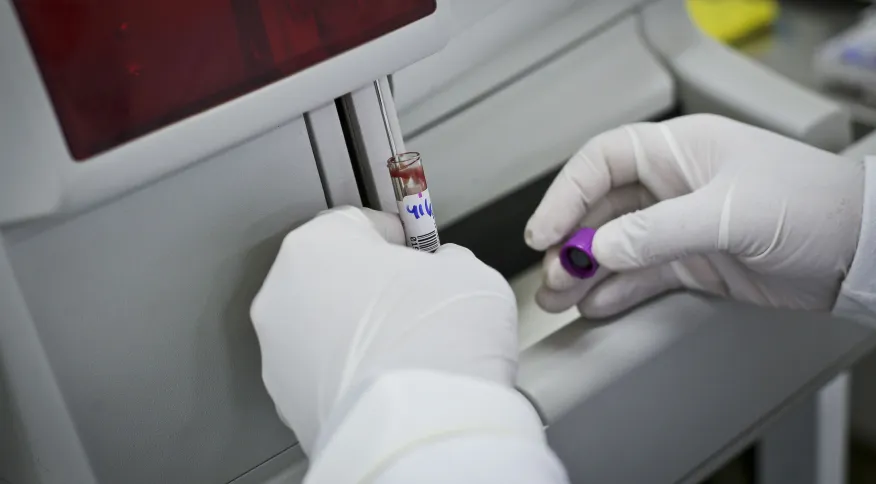 Desigualdades e estigmas prolongam pandemia de Aids