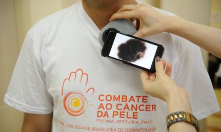 DEZEMBRO LARANJA:   Câncer de pele; tumor de maior incidência no país tem mais de 90% de chances de cura