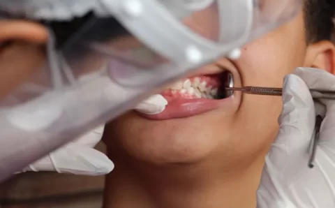 SES capacita dentistas para atendimento à pessoa com deficiência