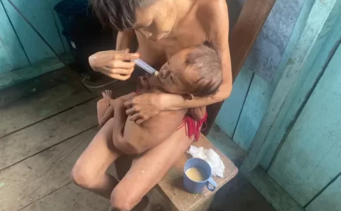 MINISTÉRIO DA SAÚDE DECRETA EMERGÊNCIA NA TERRA YANOMAMI, EM RORAIMA
