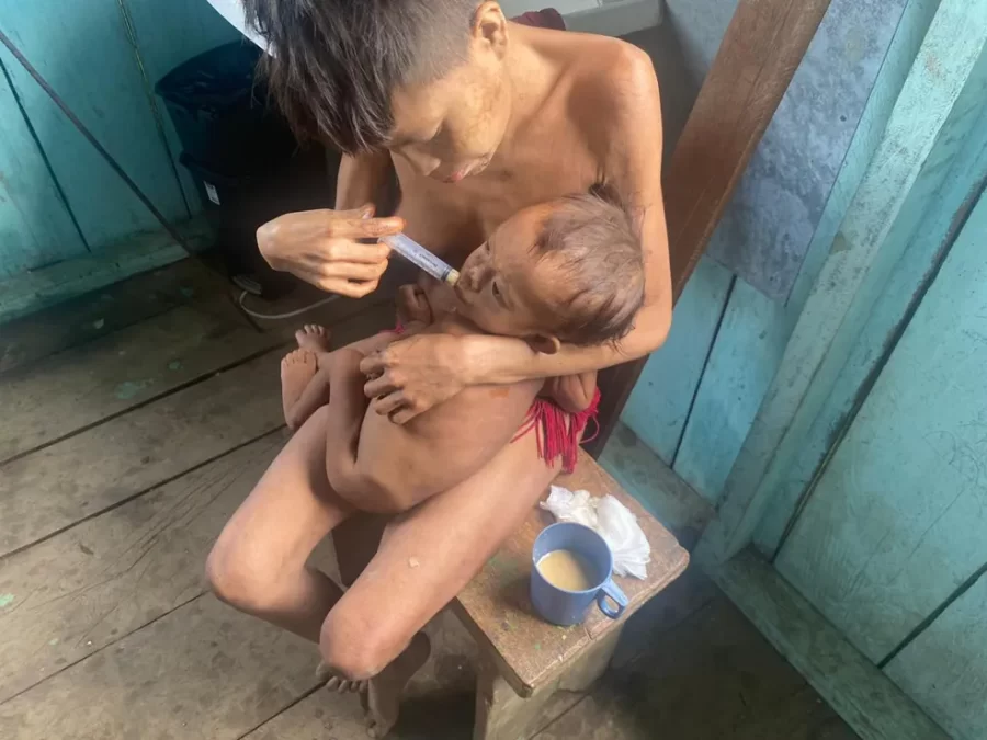 Médico que foi atender os yanomami: ‘Desnutrição extrema’