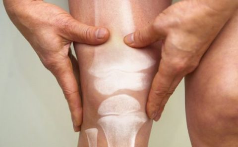 Osteoporose masculina: a doença silenciosa que causa fraturas em milhares de homens todos os anos