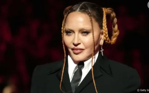 Madonna: o que se sabe de problema de saúde que levou cantora a adiar turnê mundial