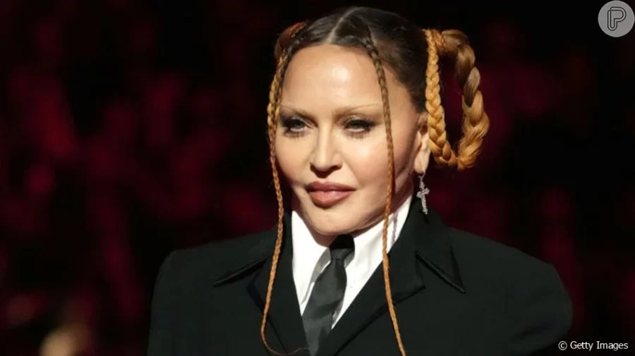 O que aconteceu com o rosto de Madonna? Especialista explica mudança no visual da cantora