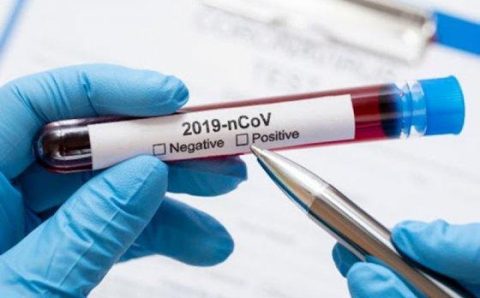 MT:  PANDEMIA SOB CONTROLE:    Com apenas 2 casos em 24h, MT chega a 12 dias sem mortes pela Covid