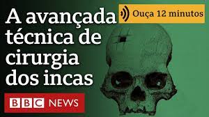 O crânio com perfuração retangular que confirmou que os incas realizavam cirurgias complexas