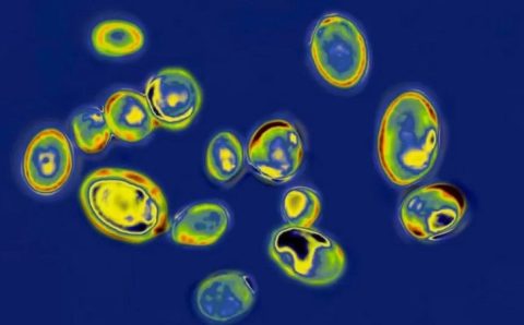 A infecção mortal por fungo que se espalha pelos EUA