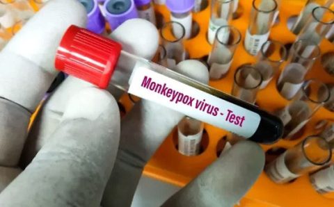 MT: ANTIGA “VARÍOLA DOS MACACOS”:   Vacinação contra mpox começa; Mato Grosso tem 116 casos da doença