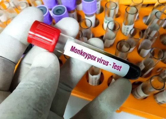 MT: ANTIGA “VARÍOLA DOS MACACOS”:   Vacinação contra mpox começa; Mato Grosso tem 116 casos da doença