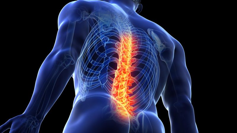 5 coisas que você deveria saber sobre dores nas costas