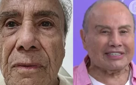 Harmonização facial de Stênio Garcia aos 91 anos: ator manda a real após críticas e memes por aparência.