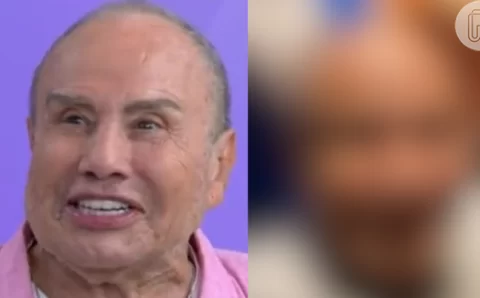 Mudou muito? Rosto de Stenio Garcia desincha e revela o verdadeiro resultado da harmonização facial. Confira!