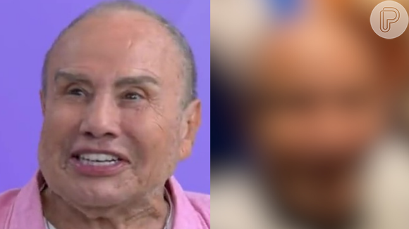 Mudou muito? Rosto de Stenio Garcia desincha e revela o verdadeiro resultado da harmonização facial. Confira!