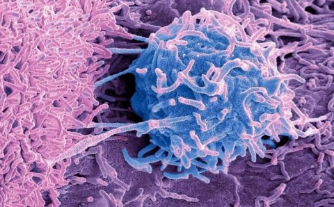 Câncer: o mistério dos micróbios que vivem em tumores