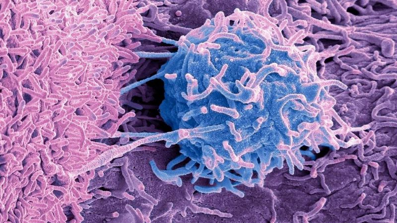 Câncer: o mistério dos micróbios que vivem em tumores