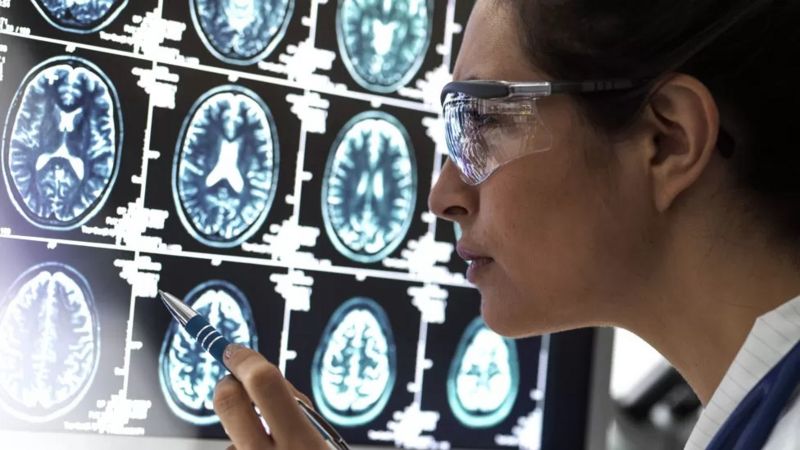 O novo remédio que ‘interrompe’ evolução do Alzheimer