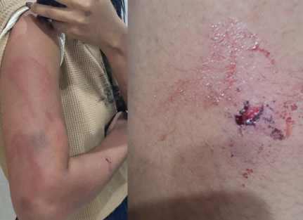 NÃO CONCORDAVA: Homem é preso acusado de agredir filha durante discussão sobre criação do neto