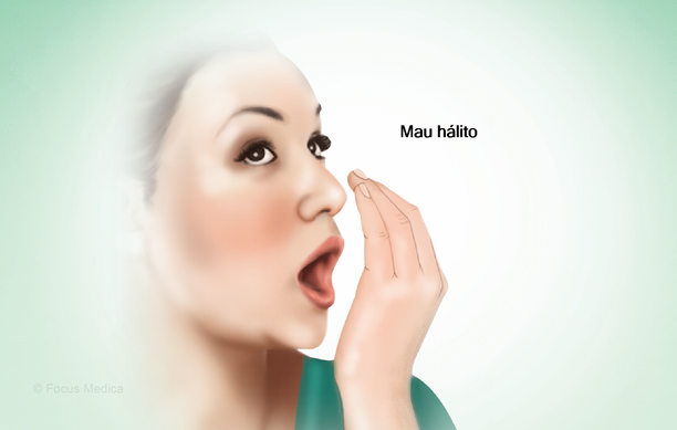 Uma condição caracterizada por respiração com odor desagradável