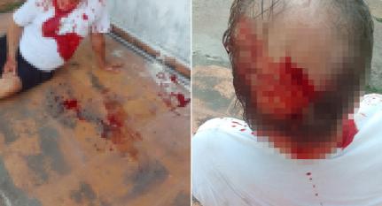 CORTE NA CABEÇA: Idoso é agredido após discussão sobre retirada de bananeiras