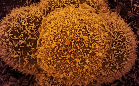 MT:   Nova subvariante da covid-19 é identificada em Mato Grosso