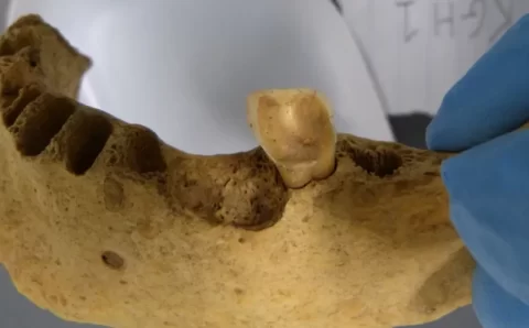 Por que nossos ancestrais não tinham cáries? Novo estudo ajuda a explicar