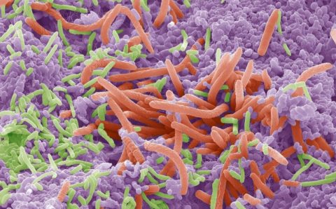 Língua artificial é criada para detectar e eliminar bactérias dentárias