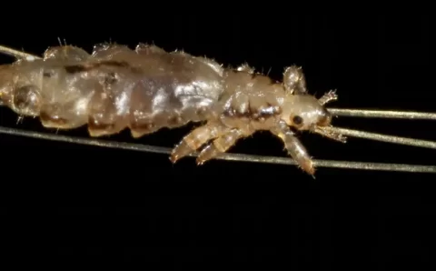 Como se livrar dos piolhos