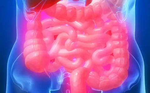 “Tenho doença rara que tem 100% de chances de virar câncer”