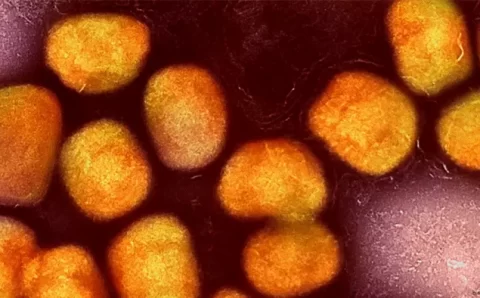 Não há relação entre mpox e vacina contra covid-19