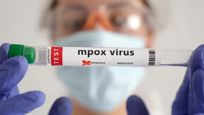 OMS: África soma quase 30 mil casos suspeitos de mpox este ano