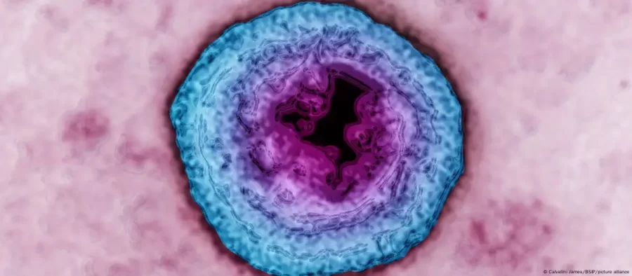 OMS: 1 em cada 5 adultos tem herpes genital