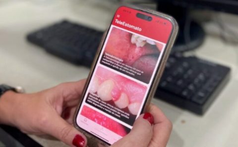 MT:  TELEESTOMATO:  Aplicativo que facilita diagnóstico do câncer de boca alcança 400 atendimentos em MT
