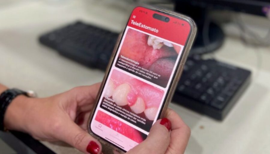 MT:  ELEESTOMATO: Aplicativo que facilita diagnóstico do câncer de boca alcança 400 atendimentos em MT