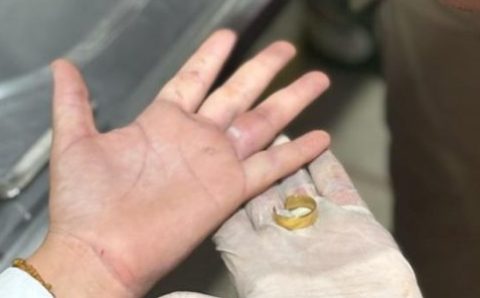 Bombeiros retiram anel que estava preso em dedo de vítima