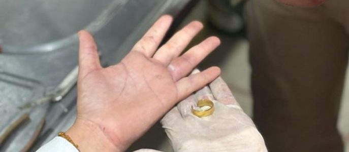 Bombeiros retiram anel que estava preso em dedo de vítima