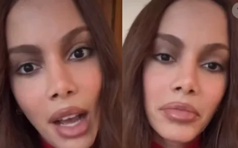 Sem ‘pé na cova’, sem cara ‘desfigurada’: Anitta fala pela 1ª vez sobre nova plástica no rosto. ‘Eu sempre fiz, mas…’