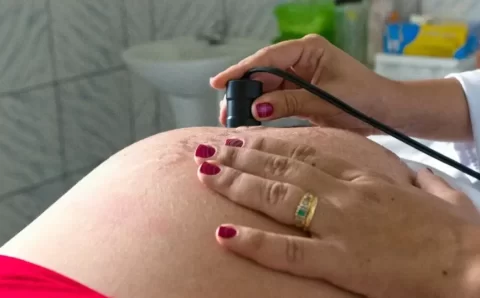 Exame pré-natal reduz chance de bebê nascer com anomalia