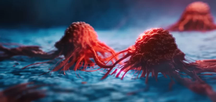 Pesquisadores brasileiros criam IA que detecta agressividade do câncer