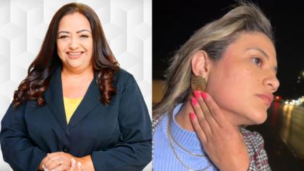 Políticos manifestam apoio e pedem orações para governador Mauro Mendes