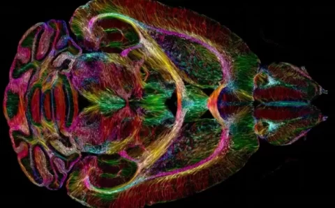 CIÊNCIA:   Onde nasce a consciência? A questão que opõe neurocientistas